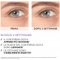 Immagine 4 - L'Oréal Paris Revitalift Siero Contorno Occhi Antirughe con Acido