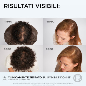 L'Oréal Paris Elvive Growth Booster Shampoo Anticaduta