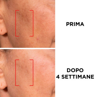 Revitalift Laser Crema Giorno Anti-Età SPF25 L'Oréal Paris