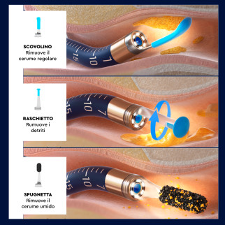 UdiGuard Pro-Clean Otoscopio Kit Pulizia Cerume Orecchie Naso e Gola