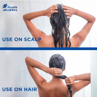 Head & Shoulders Suprême Purifica e Volume Balsamo Antiforfora con