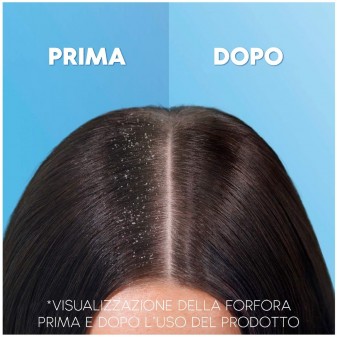 Head & Shoulders Apple Fresh Shampoo Antiforfora - Flacone da 1000ml