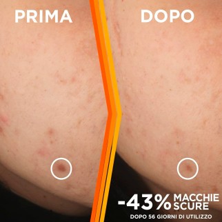 Garnier Siero Viso Anti-Macchie con Vitamina C e Acido Salicilico